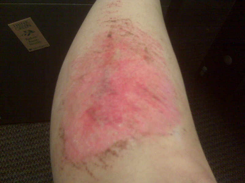 Illustration for article titled Black Eyes, Skinned Knees, And A Pitiful Excuse For A Man